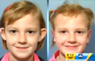 Illustration for article titled Seven-Year-Old Gets Plastic Surgery To Avoid Playground Bullying